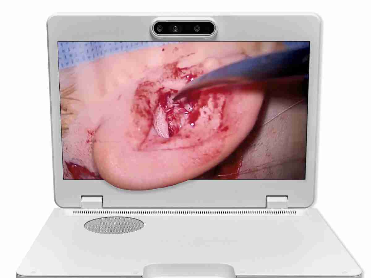 达擎之＂Heads-up 3D显微手术显示系统＂，，，，整合4K裸眼3D显示及眼球追踪系统，，具备快速追踪人眼移动位置功能，，减轻医师长时间维持固定姿势的负担，，，让医师能有更宽广清晰的3D立体视野及更舒适的姿势来执行手术。。。。